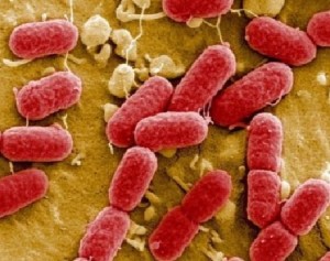Escherichia coli complicazioni