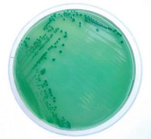 infezione da Vibrio parahaemolyticus infezione-da-vibrio-parahaemolyticus